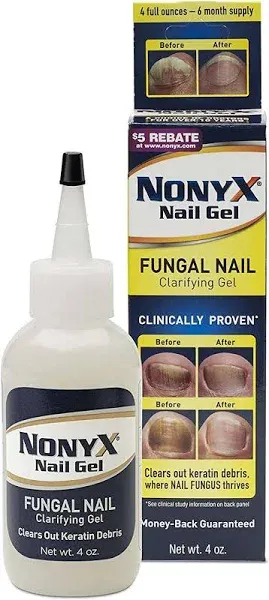 Nonyx Nail Gel 4 oz